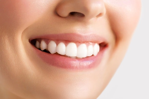 teeth-whitening-willow-point-dental-clinic